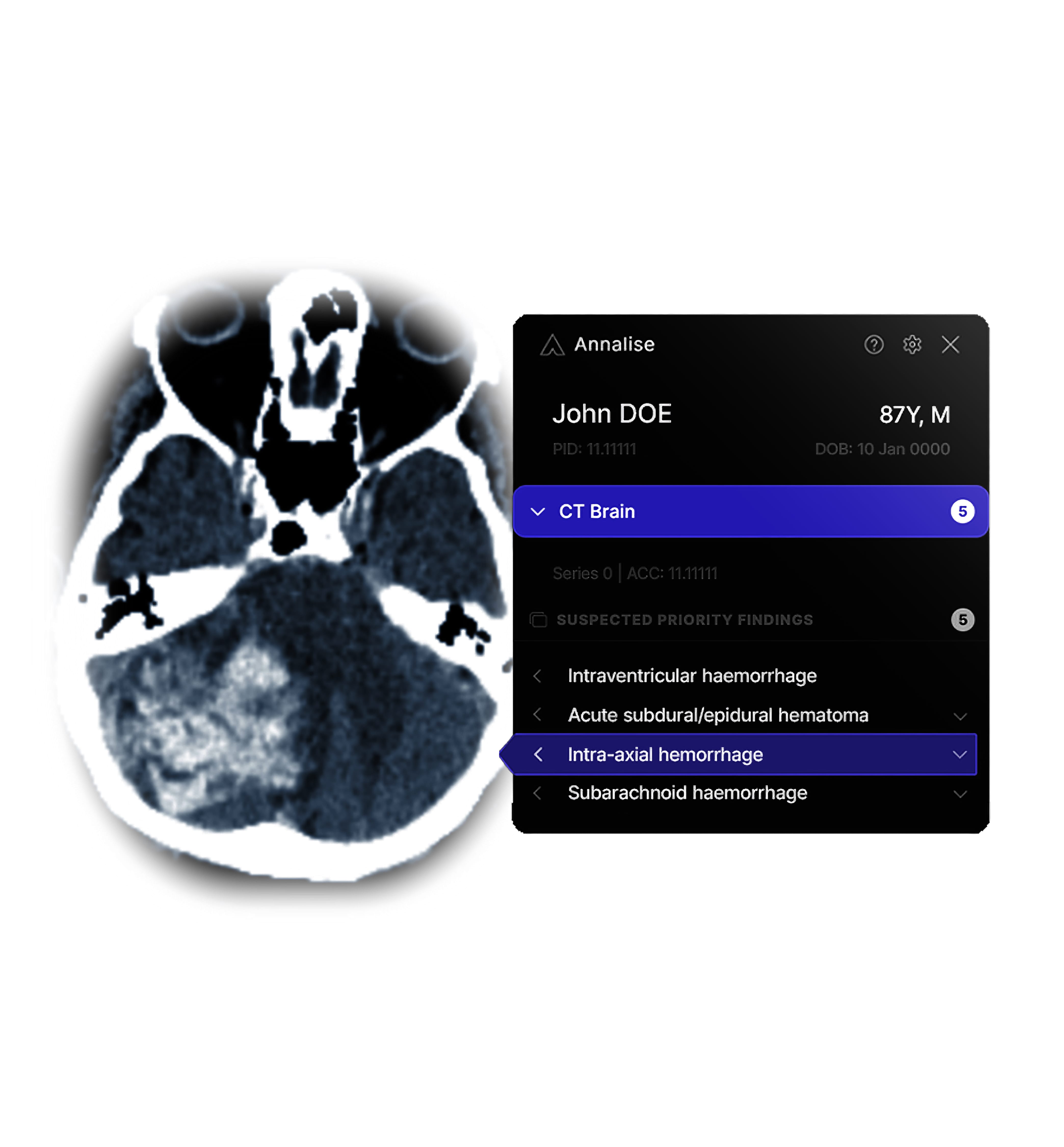 Annalise Enterprise: AI Assistant for Medical Imaging - Good Design