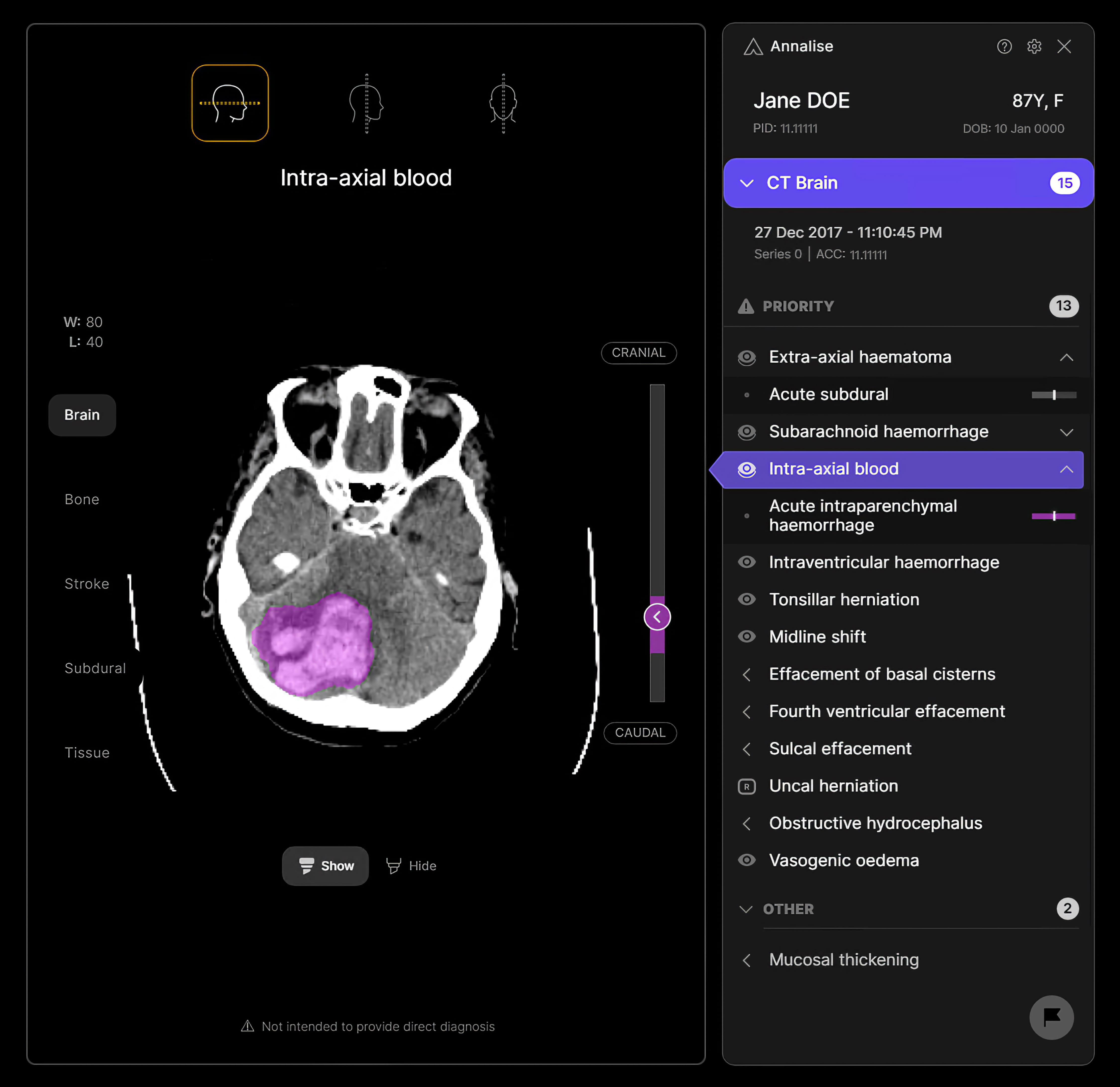 Annalise Enterprise: AI Assistant for Medical Imaging - Good Design